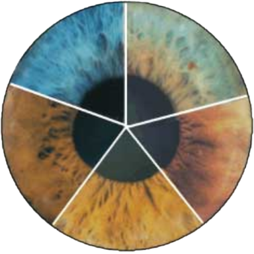 Eye